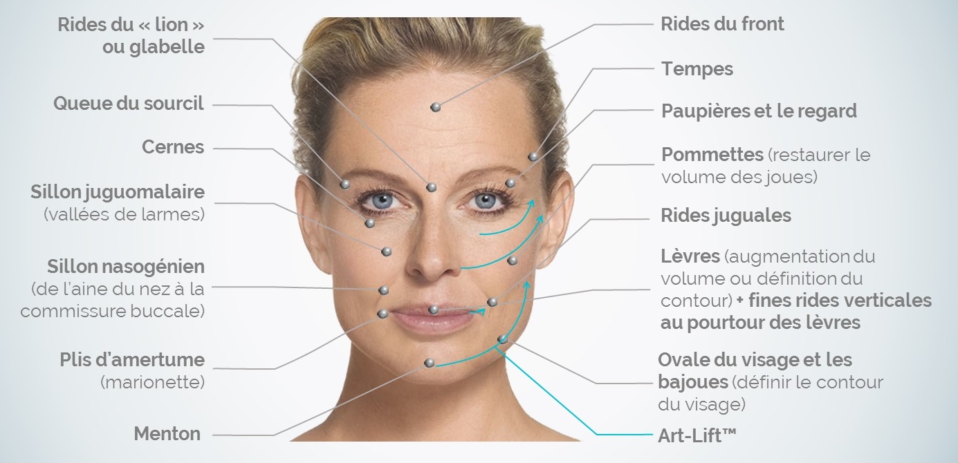 prix comblement des rides du visage prix comblement des rides du visage